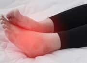 Tips Mengatasi Kaki Bengkak dengan Sederhana