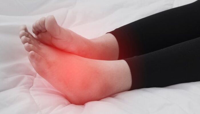 Tips Mengatasi Kaki Bengkak dengan Sederhana