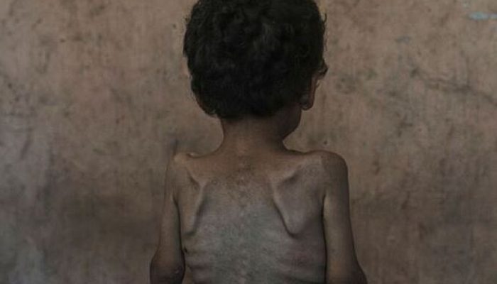 Bantuan Terhambat Blokade Masih Berlaku, 60.000 Tewas di Gaza: Dunia Diam, Anak-Anak Mati Kelaparan