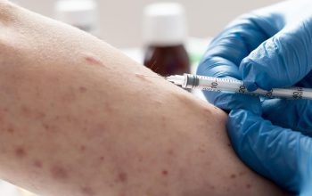 Jelang Mudik Lebaran, Kasus Campak Tembus 10 Ribu! Kemenkes Ingatkan Risiko Penularan di Kerumunan