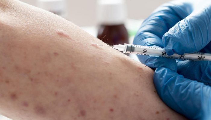 Jelang Mudik Lebaran, Kasus Campak Tembus 10 Ribu! Kemenkes Ingatkan Risiko Penularan di Kerumunan